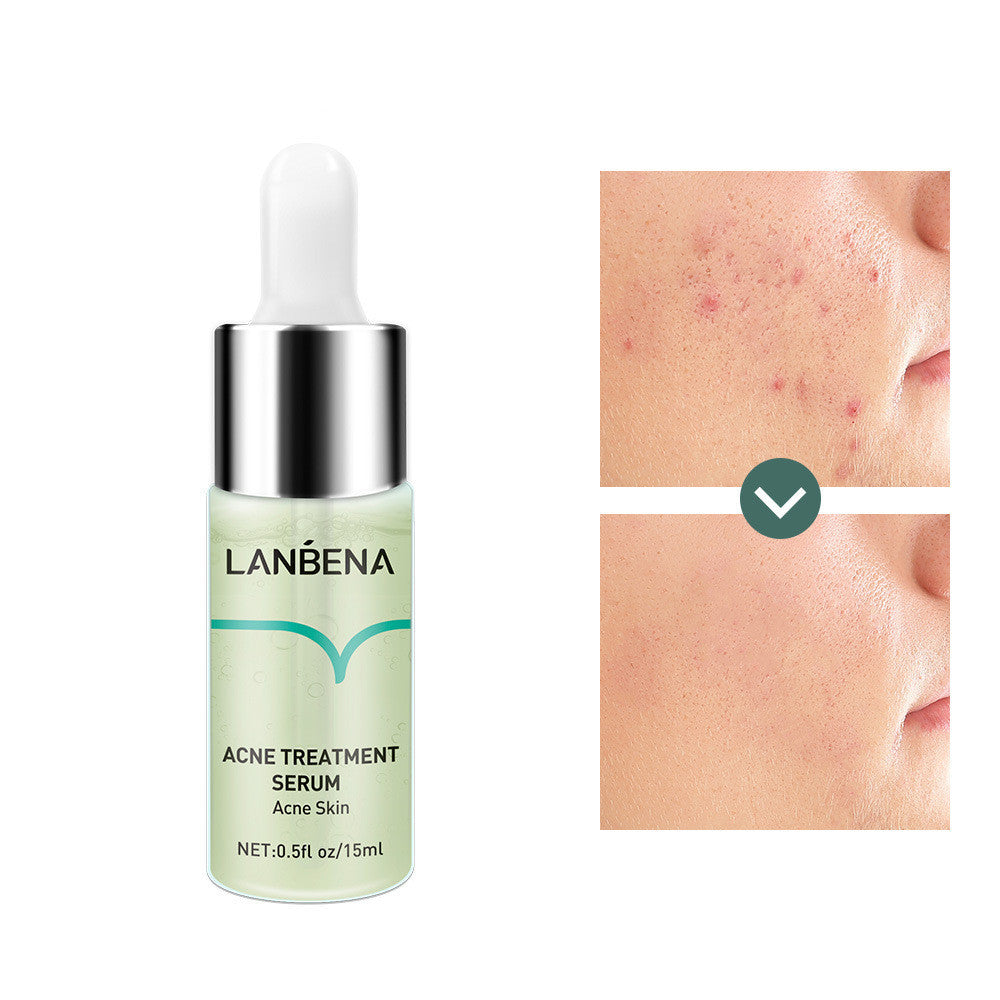 Acne Marks Repair Serum