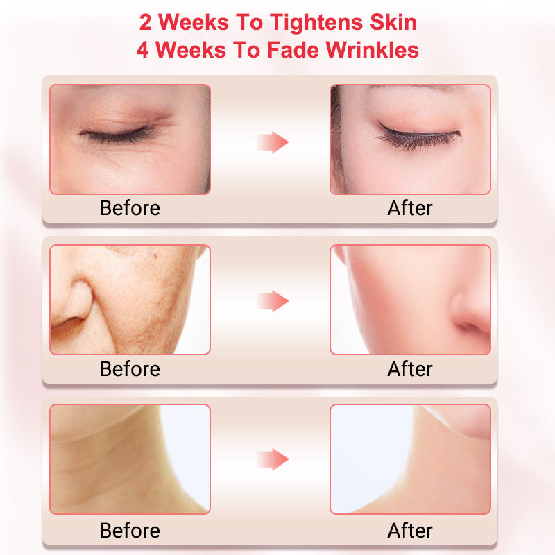 Face Lifting Skin Care